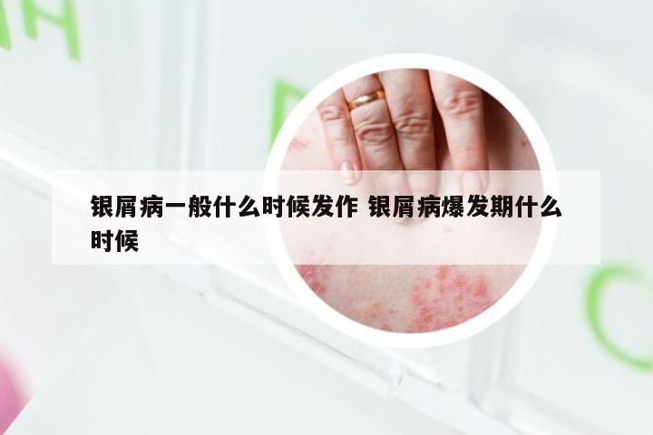银屑病一般什么时候发作 银屑病爆发期什么时候