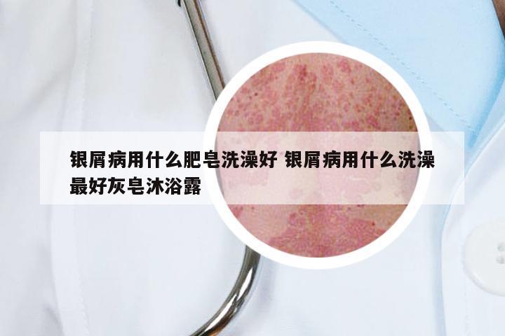 银屑病用什么肥皂洗澡好 银屑病用什么洗澡最好灰皂沐浴露