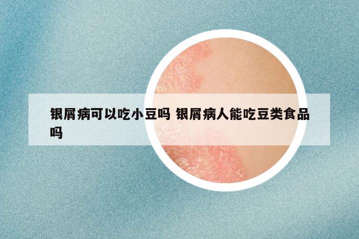 银屑病可以吃小豆吗 银屑病人能吃豆类食品吗