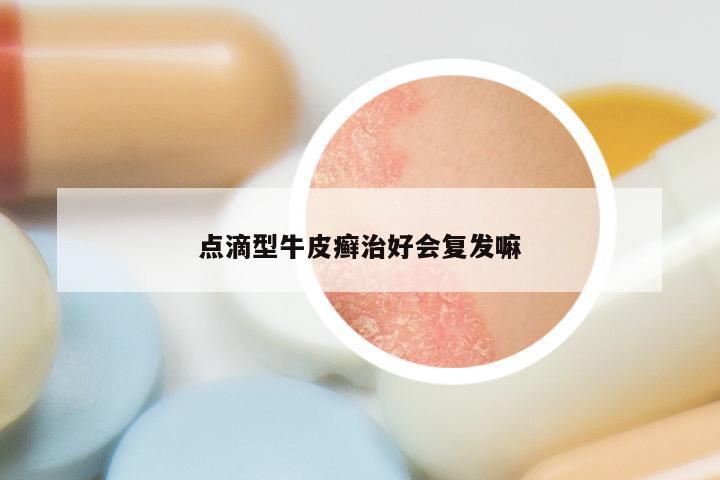 点滴型牛皮癣治好会复发嘛