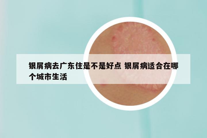 银屑病去广东住是不是好点 银屑病适合在哪个城市生活