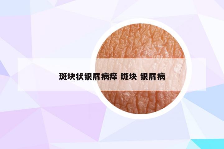 斑块状银屑病痒 斑块 银屑病