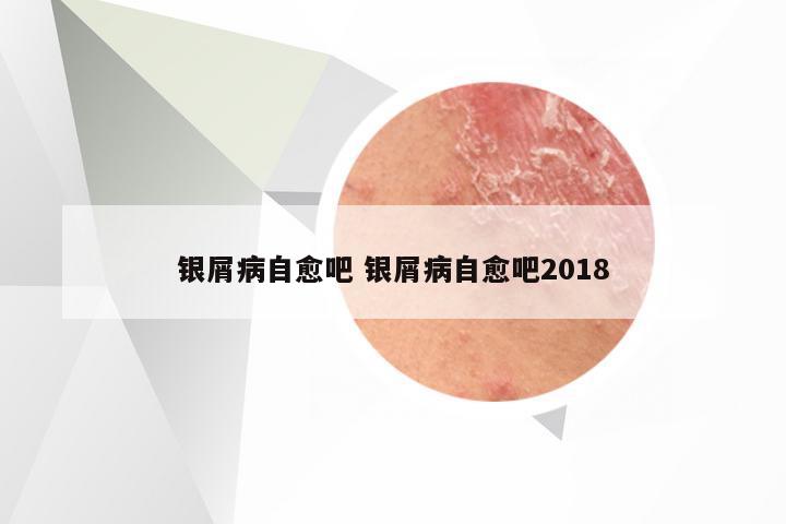 银屑病自愈吧 银屑病自愈吧2018