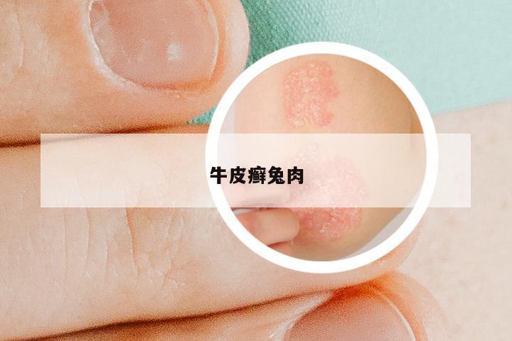 牛皮癣兔肉