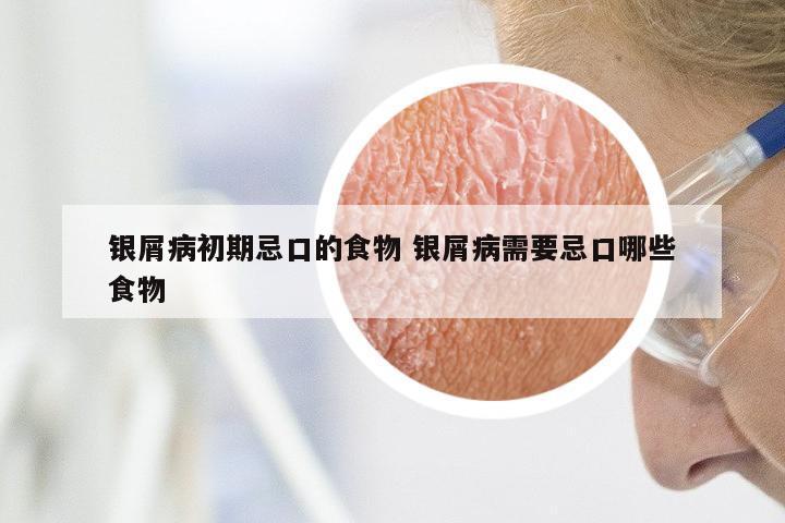 银屑病初期忌口的食物 银屑病需要忌口哪些食物