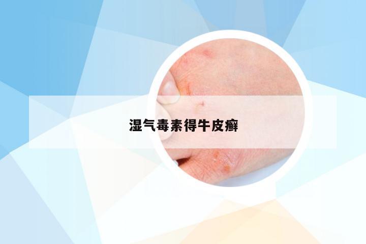 湿气毒素得牛皮癣