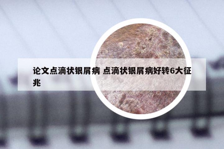 论文点滴状银屑病 点滴状银屑病好转6大征兆