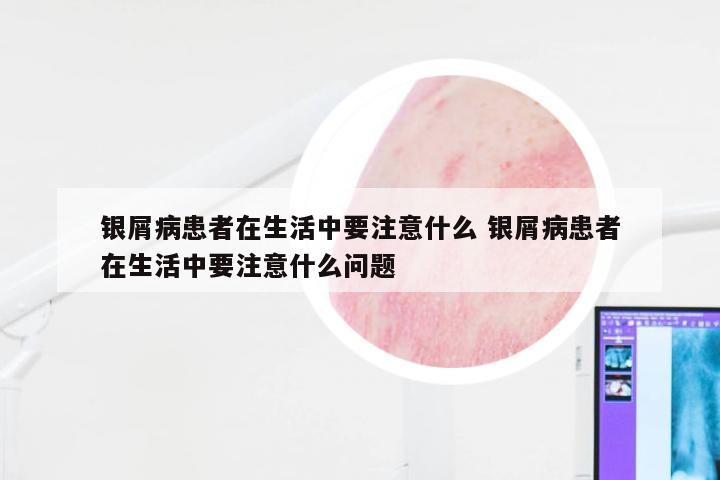 银屑病患者在生活中要注意什么 银屑病患者在生活中要注意什么问题