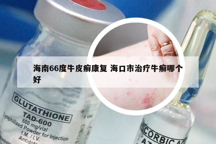 海南66度牛皮癣康复 海口市治疗牛癣哪个好