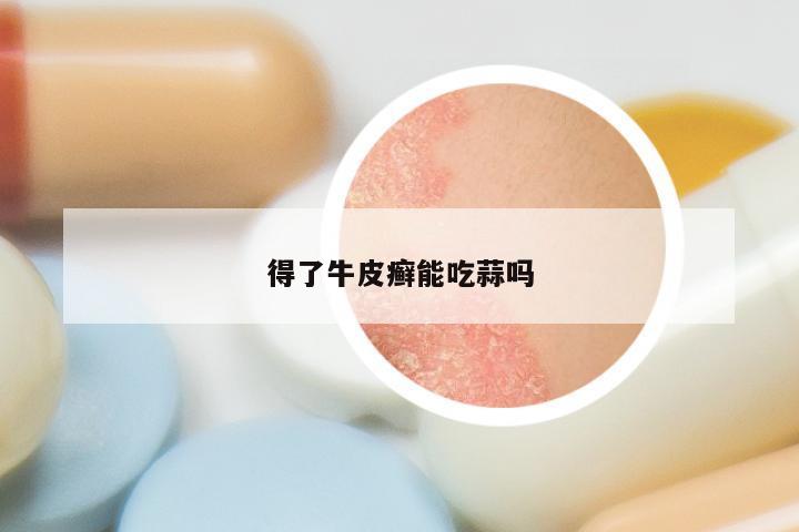 得了牛皮癣能吃蒜吗