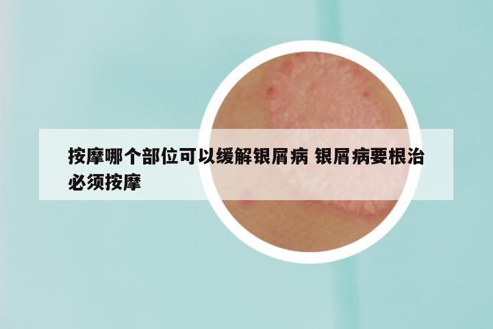 按摩哪个部位可以缓解银屑病 银屑病要根治必须按摩
