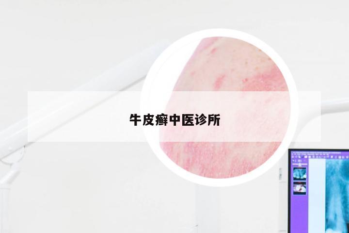 牛皮癣中医诊所