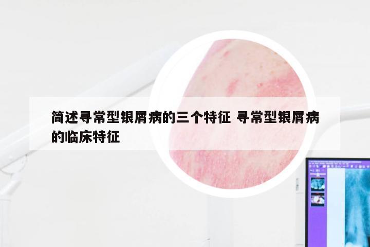 简述寻常型银屑病的三个特征 寻常型银屑病的临床特征