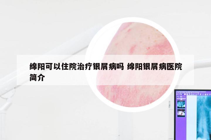 绵阳可以住院治疗银屑病吗 绵阳银屑病医院简介