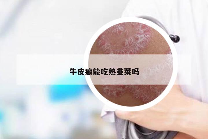 牛皮癣能吃熟韭菜吗
