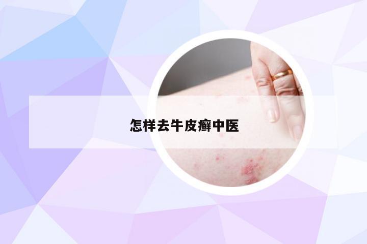 怎样去牛皮癣中医