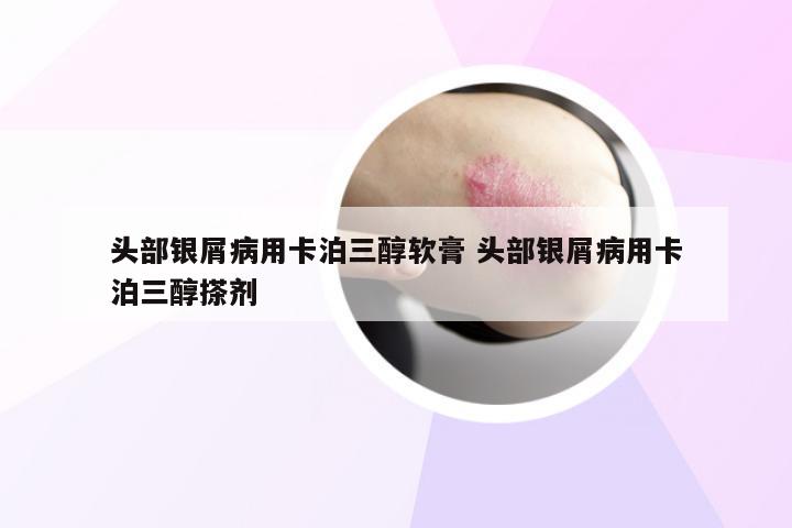 头部银屑病用卡泊三醇软膏 头部银屑病用卡泊三醇搽剂