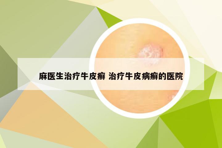 麻医生治疗牛皮癣 治疗牛皮病癣的医院