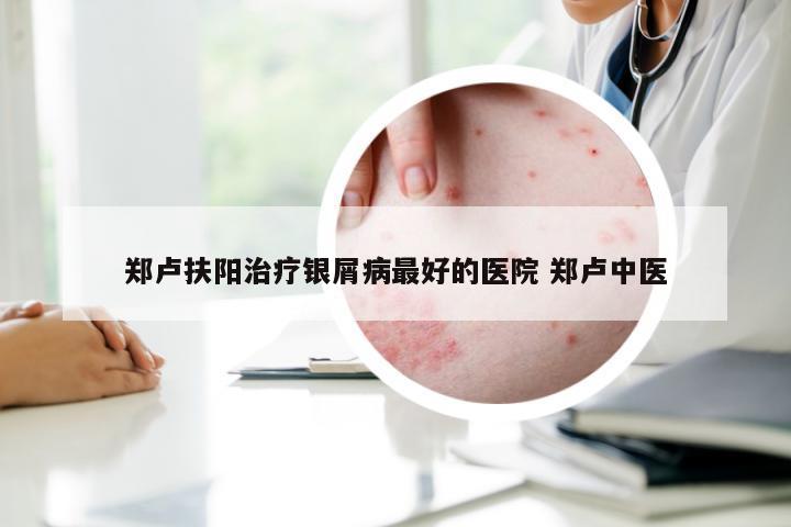 郑卢扶阳治疗银屑病最好的医院 郑卢中医