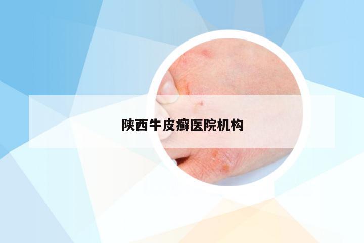陕西牛皮癣医院机构