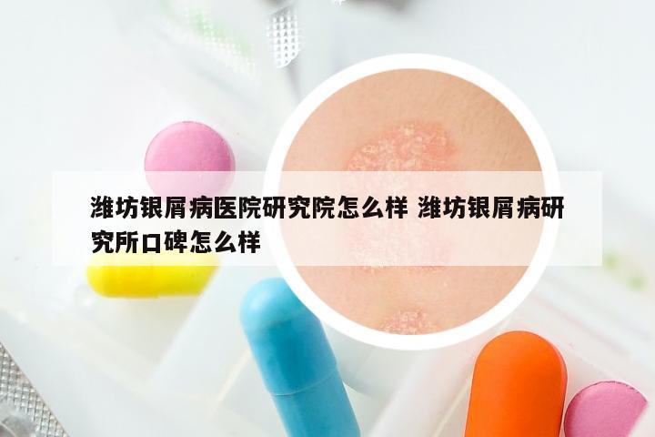 潍坊银屑病医院研究院怎么样 潍坊银屑病研究所口碑怎么样