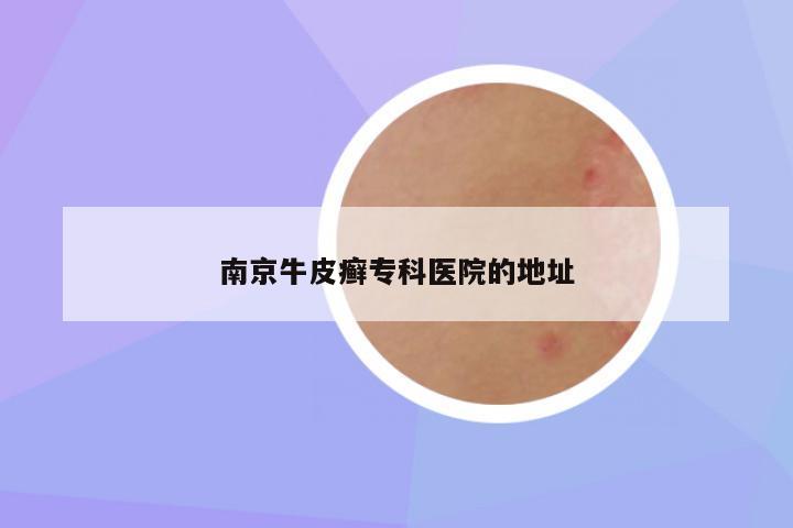 南京牛皮癣专科医院的地址