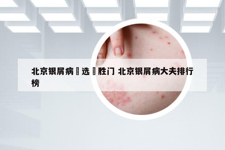 北京银屑病來选徳胜门 北京银屑病大夫排行榜