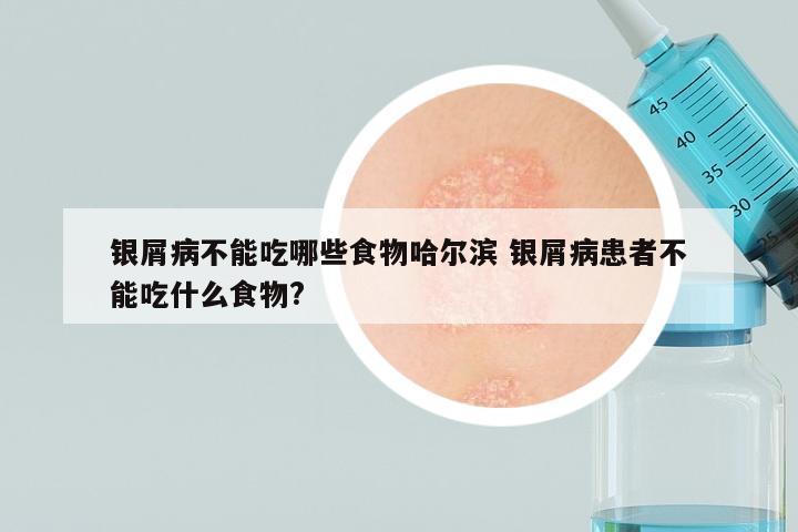 银屑病不能吃哪些食物哈尔滨 银屑病患者不能吃什么食物?