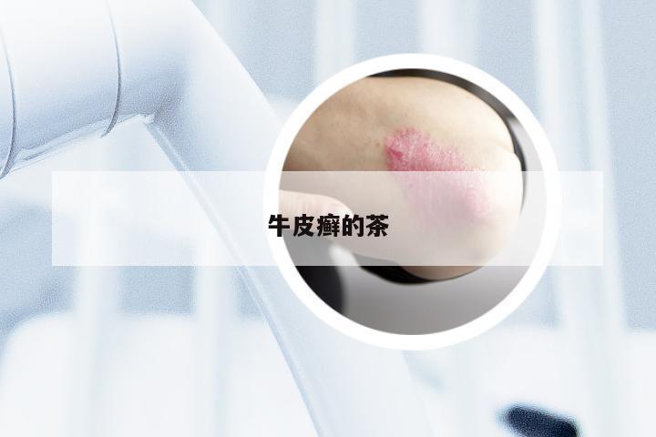 牛皮癣的茶
