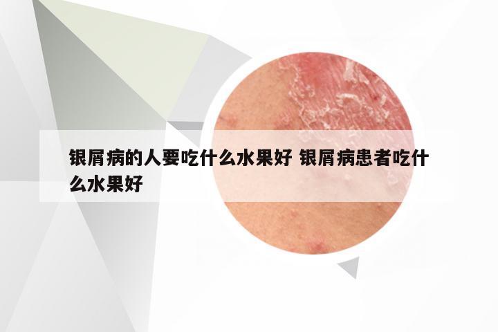 银屑病的人要吃什么水果好 银屑病患者吃什么水果好