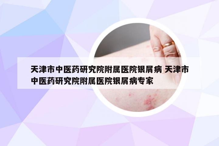 天津市中医药研究院附属医院银屑病 天津市中医药研究院附属医院银屑病专家