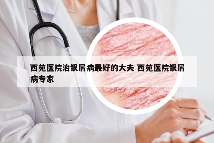 西苑医院治银屑病最好的大夫 西苑医院银屑病专家