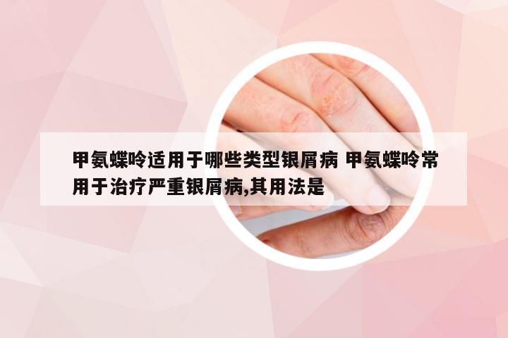 甲氨蝶呤适用于哪些类型银屑病 甲氨蝶呤常用于治疗严重银屑病,其用法是