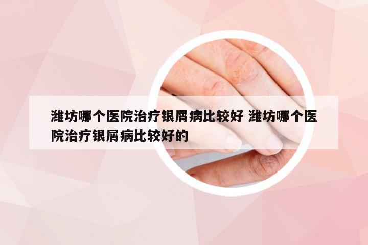潍坊哪个医院治疗银屑病比较好 潍坊哪个医院治疗银屑病比较好的