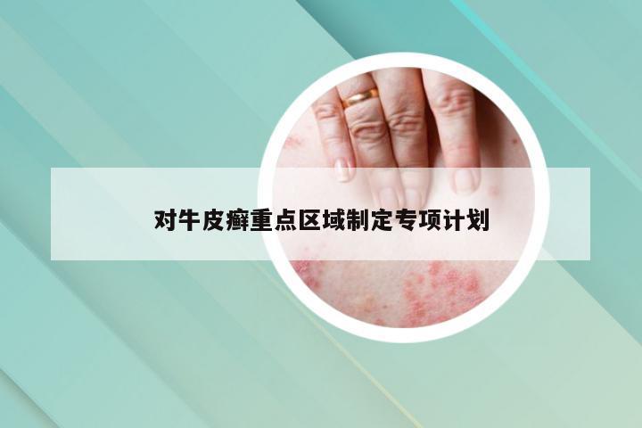 对牛皮癣重点区域制定专项计划
