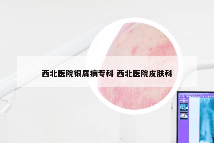 西北医院银屑病专科 西北医院皮肤科