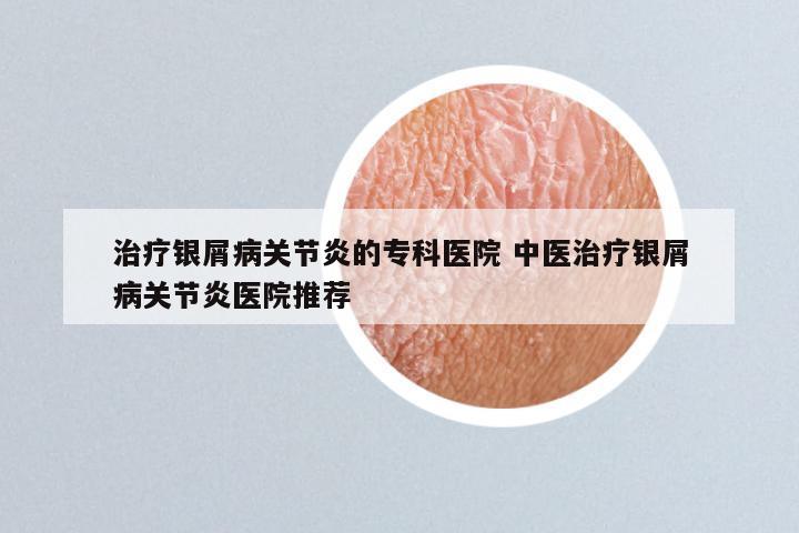 治疗银屑病关节炎的专科医院 中医治疗银屑病关节炎医院推荐
