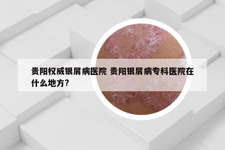 贵阳权威银屑病医院 贵阳银屑病专科医院在什么地方?