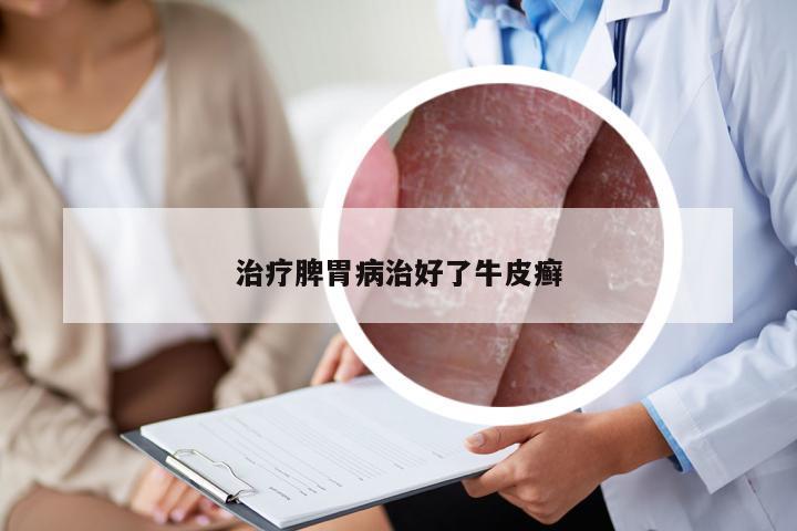 治疗脾胃病治好了牛皮癣