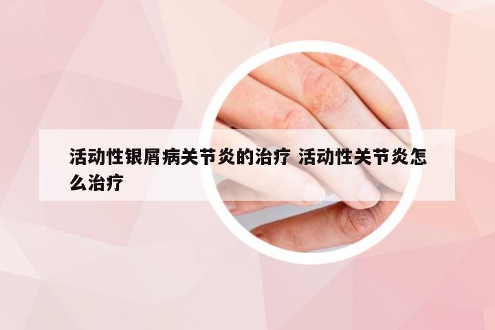 活动性银屑病关节炎的治疗 活动性关节炎怎么治疗