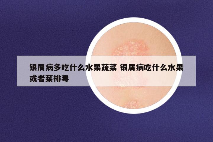 银屑病多吃什么水果蔬菜 银屑病吃什么水果或者菜排毒