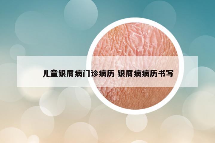 儿童银屑病门诊病历 银屑病病历书写