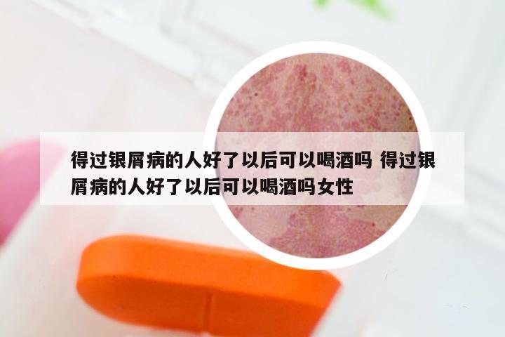 得过银屑病的人好了以后可以喝酒吗 得过银屑病的人好了以后可以喝酒吗女性