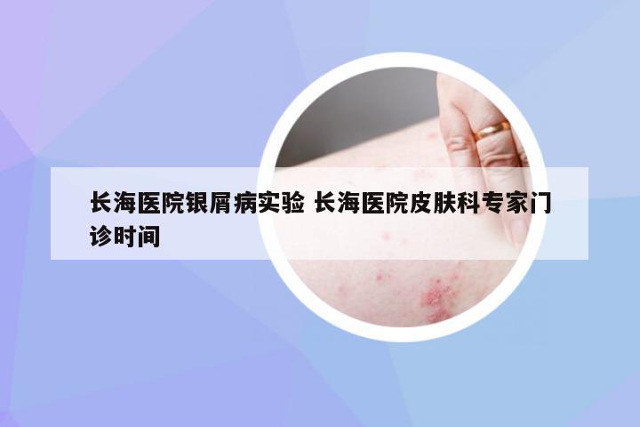 长海医院银屑病实验 长海医院皮肤科专家门诊时间