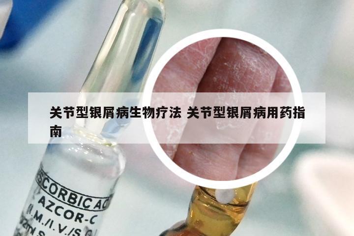 关节型银屑病生物疗法 关节型银屑病用药指南