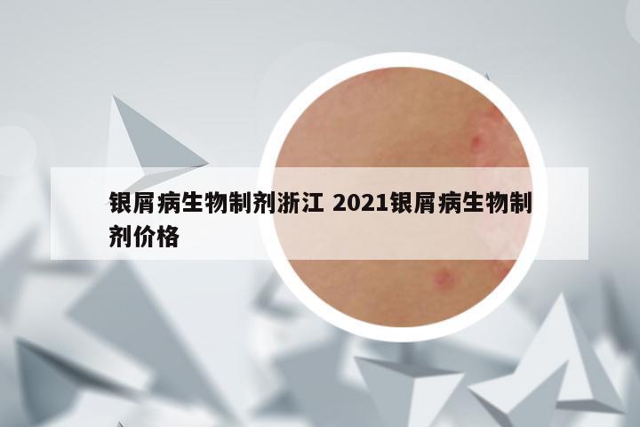 银屑病生物制剂浙江 2021银屑病生物制剂价格