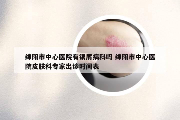 绵阳市中心医院有银屑病科吗 绵阳市中心医院皮肤科专家出诊时间表