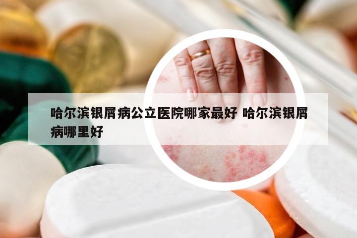 哈尔滨银屑病公立医院哪家最好 哈尔滨银屑病哪里好