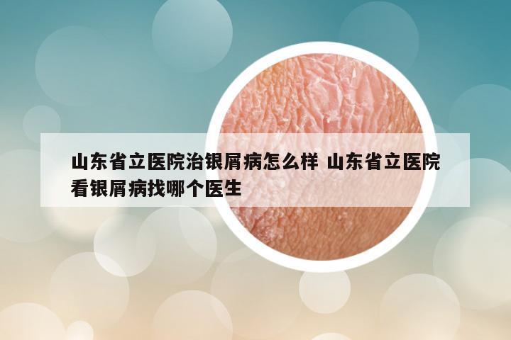 山东省立医院治银屑病怎么样 山东省立医院看银屑病找哪个医生