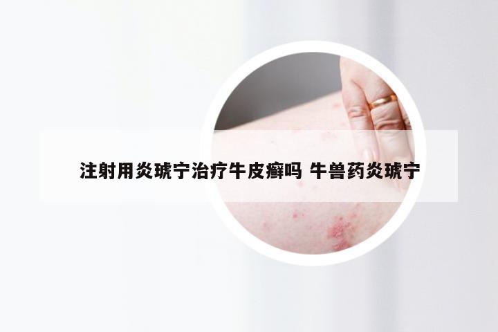 注射用炎琥宁治疗牛皮癣吗 牛兽药炎琥宁